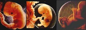 foeutus1